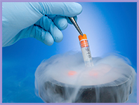 Stem Cell Storage & Cryopreservation